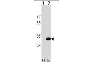 Western blot analysis of DOK5 (arrow) using rabbit polyclonal DOK5 Antibody (N-term) (ABIN1539174 and ABIN2848803). (DOK5 antibody  (N-Term))