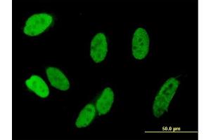 Immunofluorescence of purified MaxPab antibody to C13orf8 on HeLa cell. (ZNF828 antibody  (AA 1-812))