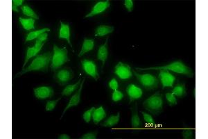 Immunofluorescence of monoclonal antibody to RP6-213H19. (STK26/MST4 antibody  (AA 331-415))