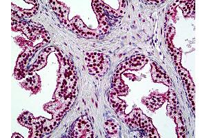Anti-SMARCA4 / BRG1 antibody IHC of human prostate. (SMARCA4 antibody  (AA 2-14))