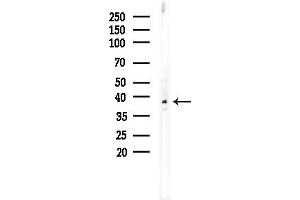 anti-Jun D Proto-Oncogene (JUND) (pSer255) antibody