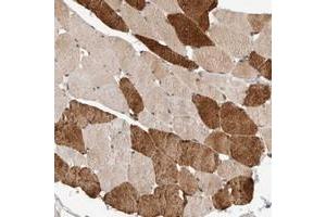 Immunohistochemical staining of human skeletal muscle with SYDE2 polyclonal antibody  shows strong cytoplasmic positivity in subsets of muscle fibers at 1:50-1:200 dilution.