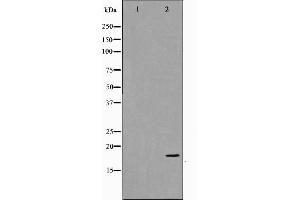 Western blot analysis on COS7 cell lysate using p18 INK Antibody,The lane on the left is treated with the antigen-specific peptide. (P18 INK antibody)