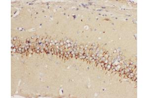 Anti-5HT1A Receptor antibody, IHC(P) IHC(P): Rat Brain Tissue