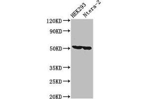 Western Blot Positive WB detected in: HEK293 whole cell lysate, Ntera-2 whole cell lysate All lanes: RUVBL1 antibody at 3. (RUVBL1 antibody  (AA 101-400))