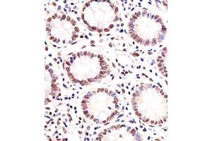 Paraformaldehyde-fixed, paraffin embedded human small intestine tissue, Antigen retrieval by boiling in sodium citrate buffer (pH6. (MGMT antibody)