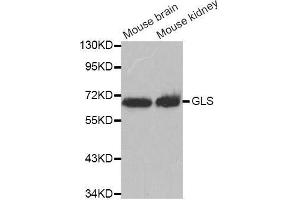 Western blot analysis of extracts of various cell lines, using GLS antibody. (Glutaminase antibody  (AA 610-669))