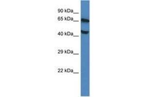 Image no. 1 for anti-Feline Leukemia Virus Subgroup C Cellular Receptor 1 (FLVCR1) (AA 223-272) antibody (ABIN6747388) (FLVCR antibody  (AA 223-272))