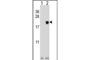 Western blot analysis of NIP7 (arrow) using rabbit polyclonal NIP7 Antibody (C-term) (ABIN652635 and ABIN2842425). (NIP7 antibody  (C-Term))