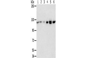 Western Blotting (WB) image for anti-RNA Binding Motif Protein 5 (RBM5) antibody (ABIN2430715)