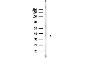 anti-Acyl-CoA Wax Alcohol Acyltransferase 2 (AWAT2) (Internal Region) antibody