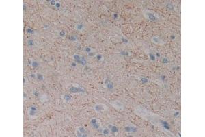 Used in DAB staining on fromalin fixed paraffin- embedded brain tissue (DLG5 antibody  (AA 1722-1905))