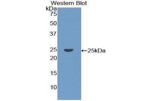 Western Blotting (WB) image for anti-Coronin, Actin Binding Protein, 1A (CORO1A) (AA 7-204) antibody (ABIN1858472) (Coronin 1a antibody  (AA 7-204))