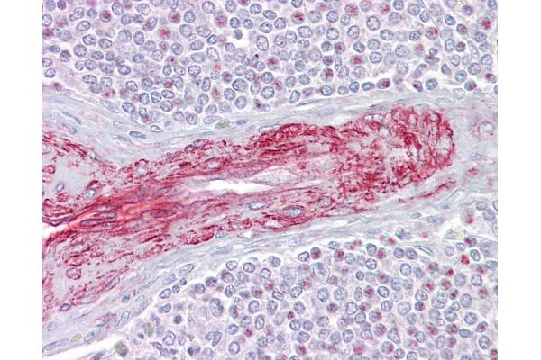 SLA antibody  (C-Term)