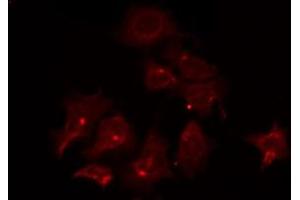 ABIN6266797 staining COLO205 by IF/ICC. (ATF6B antibody  (Internal Region))