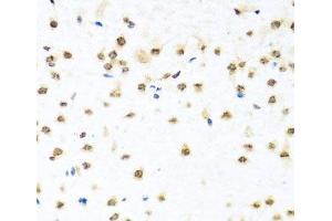 Immunohistochemistry of paraffin-embedded Mouse brain using RAB3IP Polyclonal Antibody at dilution of 1:100 (40x lens). (RAB3IP antibody)