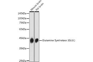 Western blot analysis of extracts of various cell lines, using Glutamine Synthetase (GLUL) antibody (ABIN6130425, ABIN6141161, ABIN6141162 and ABIN7101772) at 1:1000 dilution.