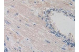 Immunohistochemistry (IHC) image for anti-Inter-alpha Trypsin Inhibitor, Heavy Chain 1 (ITIH1) (AA 507-819) antibody (ABIN7436564)