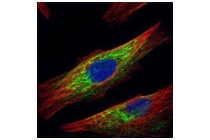 ICC/IF Image Confocal immunofluorescence analysis (Olympus FV10i) of paraformaldehyde-fixed HeLa, using HDAC6, antibody (Green) at 1:500 dilution. (HDAC6 antibody  (N-Term))