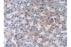 IHC-P analysis of Rat Liver Tissue, with DAB staining. (OAS1 antibody  (AA 139-358))