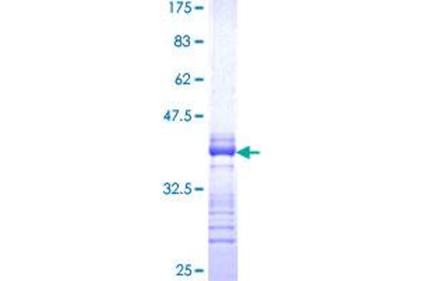 LMTK3 Protein (AA 1151-1250) (GST tag)