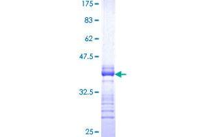 LMTK3 Protein (AA 1151-1250) (GST tag)