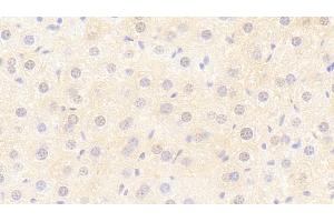 Detection of Flt3L in Mouse Liver Tissue using Polyclonal Antibody to FMS Like Tyrosine Kinase 3 Ligand (Flt3L) (FLT3LG antibody  (AA 27-189))