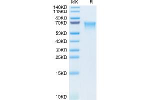 MADCAM1 Protein (AA 19-317) (His tag)