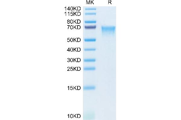 MADCAM1 Protein (AA 19-317) (His tag)