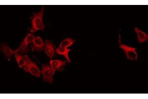 ABIN6266543 staining LOVO by IF/ICC. (GAD antibody  (C-Term))
