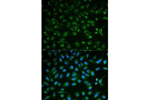 Immunofluorescence analysis of MCF7 cell using NT5E antibody. (CD73 antibody)
