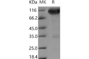 Western Blotting (WB) image for Neurotrophic Tyrosine Kinase, Receptor, Type 1 (NTRK1) (Active) protein (Fc Tag) (ABIN7321091) (TRKA Protein (Fc Tag))