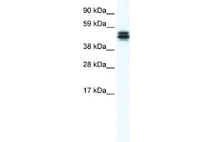 WB Suggested Anti-E130307M08RIK Antibody Titration:  1. (MPND antibody  (Middle Region))