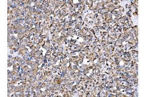 IHC analysis of MPPB/PMPCB using anti-MPPB/PMPCB antibody (ABIN7600758).