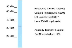 Western Blotting (WB) image for anti-Centromere Protein V (CENPV) (C-Term) antibody (ABIN2789289) (CENPV antibody  (C-Term))