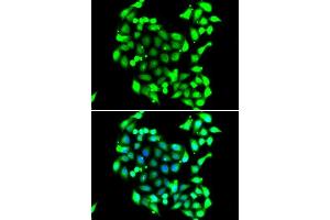 Immunofluorescence analysis of A549 cells using GTF2H3 antibody.