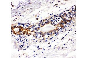 IHC analysis of Kit using anti-Kit antibody (ABIN7825521). (KIT antibody  (C-Term))