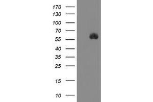 Image no. 1 for anti-serine Peptidase Inhibitor, Kunitz Type 1 (SPINT1) antibody (ABIN1501110) (SPINT1 antibody)