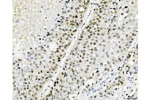 IHC analysis of Cyclophilin E/PPIE using anti-Cyclophilin E/PPIE antibody (ABIN7599242). (PPIE antibody  (AA 1-301))