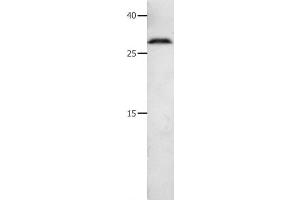 Western Blot analysis of 231 cell using MMP7 Polyclonal Antibody at dilution of 1:600 (MMP7 antibody)