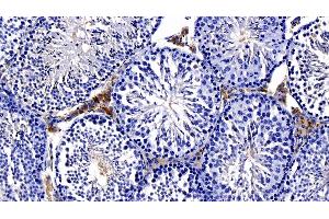 Detection of NOTCH2NL in Mouse Testis Tissue using Polyclonal Antibody to Notch2 N-Terminal Like Protein (NOTCH2NL) (NOTCH2NL antibody  (AA 1-236))