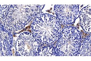 Detection of NOTCH2NL in Mouse Testis Tissue using Polyclonal Antibody to Notch2 N-Terminal Like Protein (NOTCH2NL)