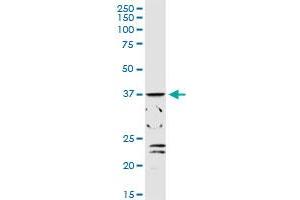 ADH1C MaxPab rabbit polyclonal antibody. (ADH1C antibody  (AA 1-375))