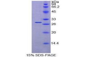 SDS-PAGE (SDS) image for Prolyl 4-Hydroxylase, beta Polypeptide (P4HB) (AA 46-258) protein (His tag) (ABIN2126489)
