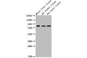 Western Blot Positive WB detected in: MMUT antibody at 1:1000 Lane 1: Mouse liver tissue Lane 2: Rat kidney tissue Lane 3: Rat heart tissue Secondary Goat polyclonal to Mouse IgG at 1/20000 dilution Predicted band size: 83 KDa Observed band size: 83 KDa Exposure time: 5 min (Histone 3 antibody  (AA 31-748))