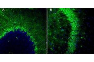 Expression of TSH receptor in mouse brain - Immunohistochemical staining of TSHR in mouse brain sections using Anti-TSH Receptor (TSHR) (extracellular)-ATTO Fluor-488 Antibody (ABIN7043811), (1:60).