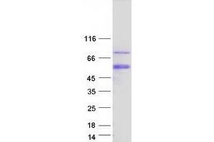 Western Blotting (WB) image for Estrogen-Related Receptor gamma (ESRRG) (Transcript Variant 4) protein (Myc-DYKDDDDK Tag) (ABIN2720566)
