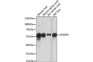 Western blot analysis of extracts of various cell lines, using HOXD3 antibody (ABIN6290493) at 1:1000 dilution.