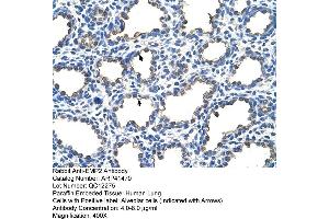Rabbit Anti-EMP2 Antibody  Paraffin Embedded Tissue: Human Lung Cellular Data: Alveolar cells Antibody Concentration: 4. (EMP2 antibody  (Middle Region))