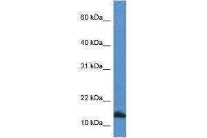 Western Blot showing CDA antibody used at a concentration of 1 ug/ml against HepG2 Cell Lysate (CDA antibody  (C-Term))
